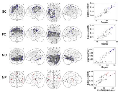 Multiplex core of the human brain using structural, functional and metabolic connectivity derived from hybrid PET-MR imaging